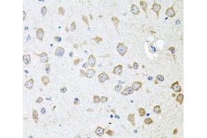 Immunohistochemistry of paraffin-embedded Mouse brain using AKAP5 Polyclonal Antibody at dilution of 1:100 (40x lens). (AKAP5 antibody)