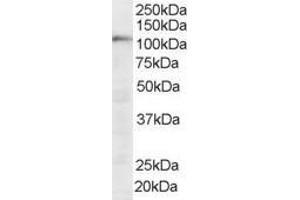 Western Blotting (WB) image for anti-Squamous Cell Carcinoma Antigen Recognized By T Cells (SART1) (N-Term) antibody (ABIN2466239) (SART1 antibody  (N-Term))
