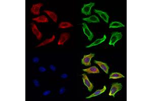 ABIN6263424 and ABIN6269252 staining Hela cells by IF/ICC. (MTOR antibody  (C-Term))