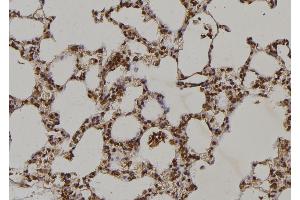 ABIN6269229 at 1/100 staining Rat lung tissue by IHC-P. (MEK2 antibody  (C-Term))