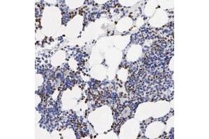 Immunohistochemical staining of human bone marrow with SPIN3 polyclonal antibody  shows strong nuclear and cytoplasmic positivity in bone marrow poietic cells.