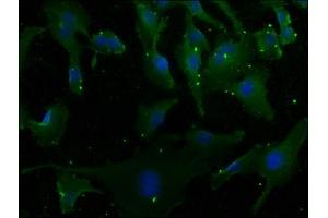 Immunofluorescence staining of U251 cells with ABIN7166480 at 1:50, counter-stained with DAPI. (MCF2 antibody  (AA 705-925))