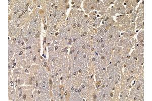 ABIN6258224 and ABIN6275160 at 1/100 staining rat brain tissue by IHC-P. (GRB2 antibody  (C-Term))