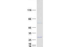 Validation with Western Blot (RPL18 Protein (Myc-DYKDDDDK Tag))