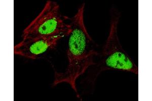 Fluorescent confocal image of SY5Y cells stained with (ABIN655156 and ABIN2844774) LIN28A (Center) antibody. (LIN28A antibody  (AA 108-138))