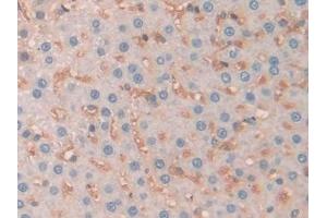 Detection of SERPINA10 in Rat Liver Tissue using Polyclonal Antibody to Serpin A10 (SERPINA10) (SERPINA10 antibody  (AA 278-425))