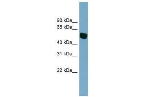 SLC38A5 antibody used at 1 ug/ml to detect target protein.