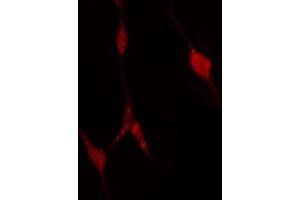 ABIN6274311 staining A549 cells by IF/ICC. (PFKP antibody  (Internal Region))