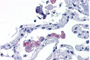 Human Lung: Formalin-Fixed, Paraffin-Embedded (FFPE) (TLR7 antibody  (AA 900-950))