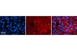 Rabbit Anti-RARA Antibody    Formalin Fixed Paraffin Embedded Tissue: Human Adult liver  Observed Staining: Cytoplasmic (abundant), Nuclear (very rare) Primary Antibody Concentration: 1:100 Secondary Antibody: Donkey anti-Rabbit-Cy2/3 Secondary Antibody Concentration: 1:200 Magnification: 20X Exposure Time: 0. (Retinoic Acid Receptor alpha antibody  (Middle Region))