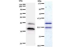 Left: BBX staining. (BBX antibody)