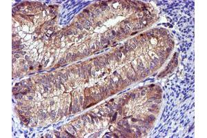 Image no. 3 for anti-LIM Domain Kinase 1 (LIMK1) antibody (ABIN1499147)