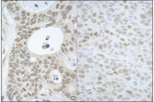 anti-Cullin-Associated and Neddylation-Dissociated 1 (CAND1) (AA 1180-1230) antibody