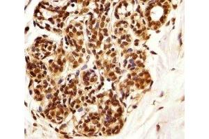 Immunohistochemical analysis of paraffin-embedded human breast using PIN1 antibody at 1:25 dilution. (PIN1 antibody)