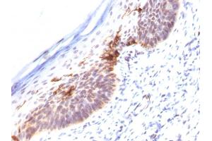 Formalin-fixed, paraffin-embedded human Skin stained with CD1a Monoclonal Antibody (SPM120). (CD1a antibody)