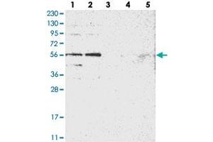 Western blot analysis of Lane 1: RT-4, Lane 2: U-251 MG, Lane 3: Human Plasma, Lane 4: Liver, Lane 5: Tonsil with FAM116B polyclonal antibody . (DENND6B antibody)