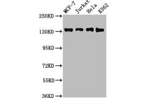 Western Blot Positive WB detected in: MCF-7 whole cell lysate, Jurkat whole cell lysate, Hela whole cell lysate, K562 whole cell lysate All lanes: WAPL antibody at 2. (WAPAL antibody  (AA 1037-1190))