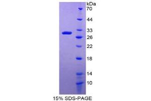 SDS-PAGE (SDS) image for Damage-Specific DNA Binding Protein 2, 48kDa (DDB2) (AA 166-383) protein (His tag) (ABIN1980714) (DDB2 Protein (AA 166-383) (His tag))