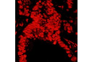 Immunofluorescence (IF) image for anti-Matrin 3 (MATR3) (C-Term) antibody (ABIN7455225) (MATR3 antibody  (C-Term))