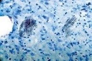 Immunohistochemistry (IHC) image for anti-Purinergic Receptor P2Y, G-Protein Coupled, 1 (P2RY1) (AA 242-258) antibody (ABIN7043583)