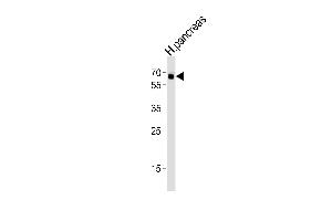 Western blot analysis of lysate from human pancreas tissue lysate, using ACVR2B Antibody (S14) A. (ACVR2B antibody  (AA 1-30))