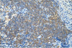 Immunohistochemistry was performed on paraffin-embedded human tonsillitis using PTPN6 antibody (ABIN7800046), 1:200).