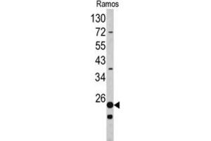 Western Blotting (WB) image for anti-Ribosomal Protein S9 (RPS9) antibody (ABIN3002715) (RPS9 antibody)