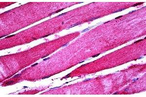 Human Skeletal Muscle: Formalin-Fixed, Paraffin-Embedded (FFPE) (ENO3 antibody  (AA 228-278))
