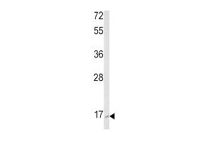 Western blot analysis of RAC2 Antibody (C-term) (ABIN652785 and ABIN2842514) in K562 cell line lysates (35 μg/lane). (RAC2 antibody  (C-Term))