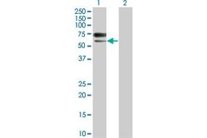 Western Blot analysis of ACVRL1 expression in transfected 293T cell line by ACVRL1 monoclonal antibody (M02), clone 7H2. (ACVRL1 antibody  (AA 22-119))