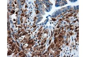 Immunohistochemical staining of paraffin-embedded Kidney tissue using anti-RC219453 mouse monoclonal antibody. (NPR3 antibody)