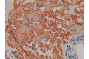 DAB staining on IHC-P; Samples: Human Prostate Tissue (IFNA7 antibody  (AA 24-189))
