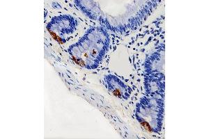 Immunohistochemical analysis of paraffin-embedded R. (LYZ antibody  (C-Term))