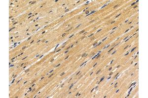 ABIN6256860 and ABIN6274329 at 1/100 staining Rat heart tissue by IHC-P.