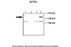 Lanes:   Lane1: 10 ug ACTN1-GFP transfected COS-7 lysate Lane2: 10 ug ACTN2-GFP transfected COS-7 lysate Lane3: 10 ug ACTN3-GFP transfected COS-7 lysate Lane4: 10 ug ACTN4-GFP transfected COS-7 lysate  Primary Antibody Dilution:   1: 1000  Secondary Antibody:   Anti-rabbit HRP  Secondary Antibody Dilution:   1:5000  Gene Name:   ACTN4  Submitted by:   Johannes W. (alpha Actinin 4 antibody  (C-Term))