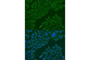 Immunofluorescence analysis of U2OS cells using B3GALNT1 antibody (ABIN2736338) at dilution of 1:100.