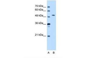 Image no. 1 for anti-serine threonine Kinase 39 (STK39) (AA 151-200) antibody (ABIN321508) (STK39 antibody  (AA 151-200))