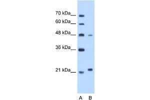 WB Suggested Anti-MMP1 Antibody Titration:  1. (MMP1 antibody  (N-Term))