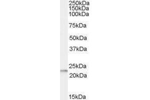 Western Blotting (WB) image for Ribosomal Protein L17 (RPL17) peptide (ABIN370436) (Ribosomal Protein L17 (RPL17) Peptide)