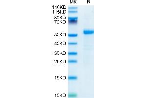 Human DLL3 on Tris-Bis PAGE under reduced  condition. (DLL3 Protein (AA 27-490) (His tag))