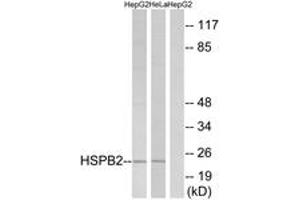 Western blot analysis of extracts from HepG2/HeLa cells, using HSPB2 Antibody. (HSPB2 antibody  (AA 121-170))