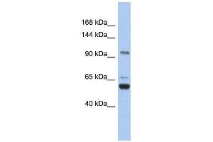 TRPM8 antibody used at 1 ug/ml to detect target protein. (TRPM8 antibody  (N-Term))