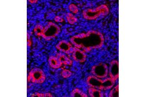 Immunofluorescence of paraffin embedded mouse uterus using CK13 (ABIN7074411) at dilution of 1:500 (400x lens) (Cytokeratin 13 antibody  (C-Term))