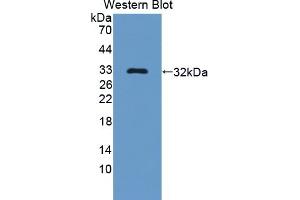 Detection of Recombinant Bcl11A, Human using Polyclonal Antibody to B-Cell CLL/Lymphoma 11A (Bcl11A) (BCL11A antibody  (AA 1-210))