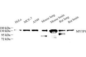 Western blot analysis of MYTP1 (ABIN7074731) at dilution of 1: 500 (Myosin Binding Subunit antibody)
