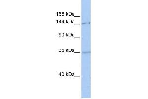 WB Suggested Anti-SMC1A Antibody Titration:  0. (SMC1A antibody  (C-Term))