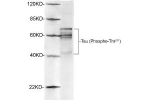 Western blot analysis of rat brain lysates using 1 µg/mL Antibodies-Online Rabbit Anti-Tau (Phospho-Thr217) Polyclonal Antibody (ABIN398308) The signal was developed with IRDyeTM 800 Conjugated Goat Anti-Rabbit IgG. (tau antibody  (pThr217))