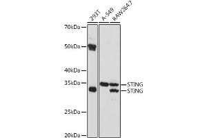 Western blot analysis of extracts of various cell lines, using STING antibody (ABIN7270958) at 1:1000 dilution.