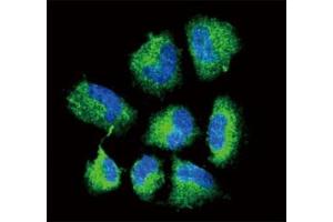Confocal immunofluorescent analysis of CHAT antibody with NCI-H460 cells followed by Alexa Fluor 488-conjugated goat anti-rabbit lgG (green). (Choline Acetyltransferase antibody  (AA 98-128))