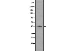 Western blot analysis of RRAGA using HepG2 whole  lysates. (RRAGA antibody  (C-Term))